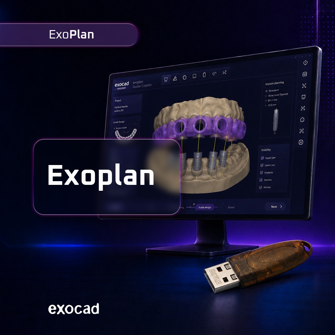 Exoplan
